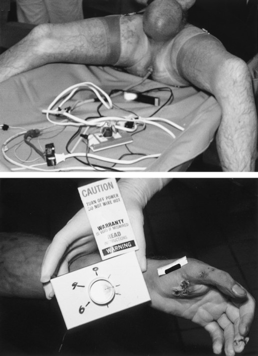 anal-implementation